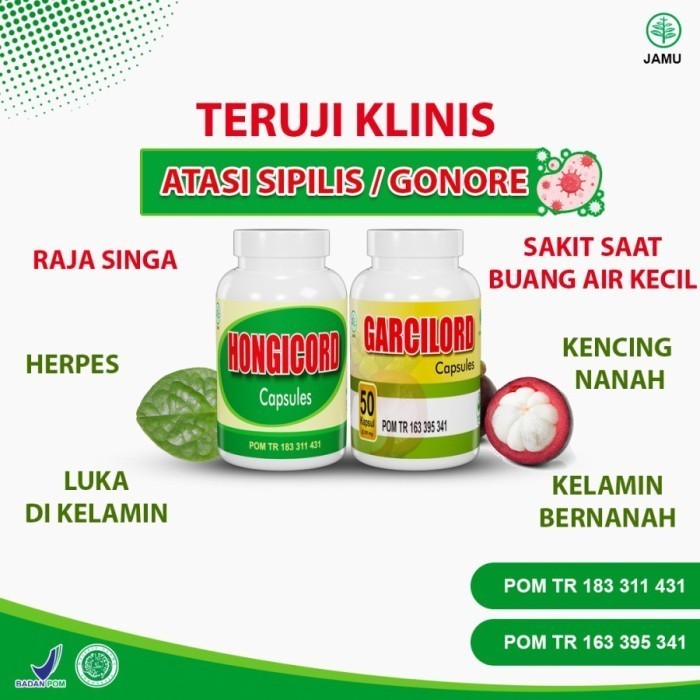 Warung Kopi di Jalan Ir Juanda: Saingan Rival Saat Citimall Datang